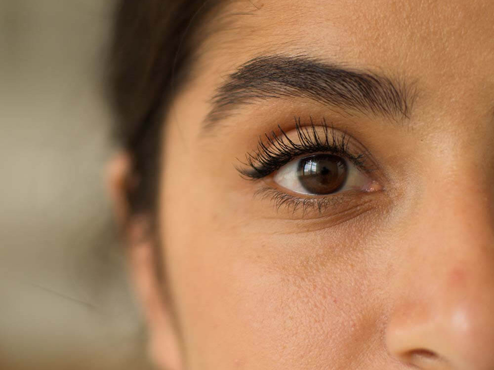 Eyebrow Transplant