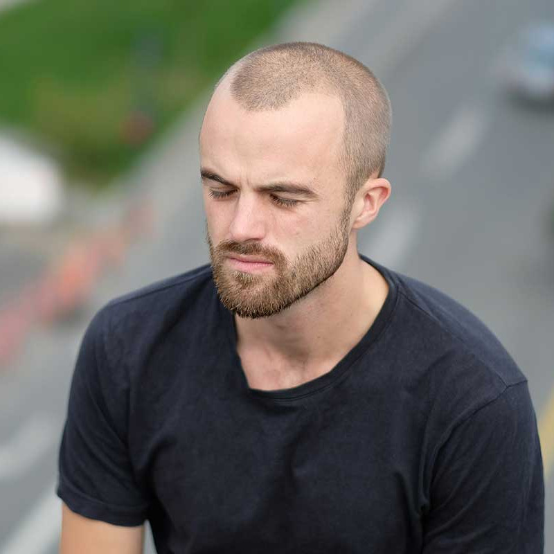 A photo of a man with a balding head and a beard. This image is used to illustrate the page About Elscott Medical.