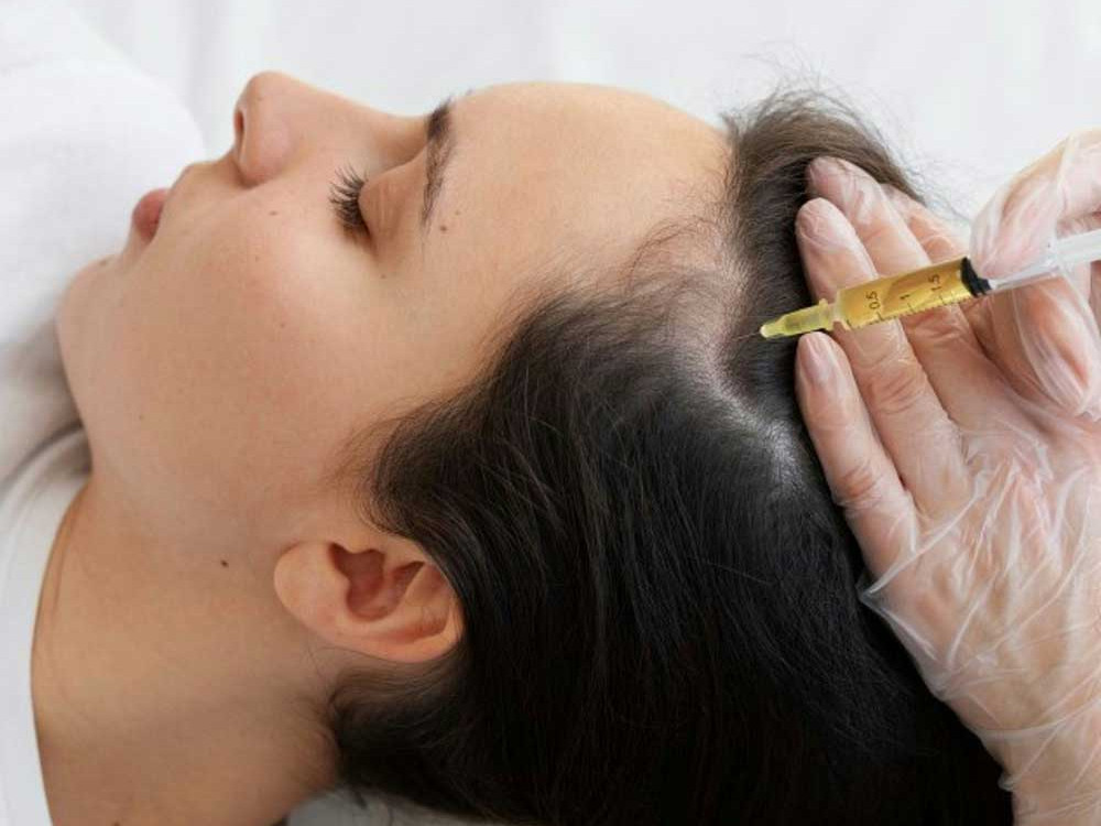 A photo of a patient having an injection to her scalp. This image is being used to represent Regenerative Injections