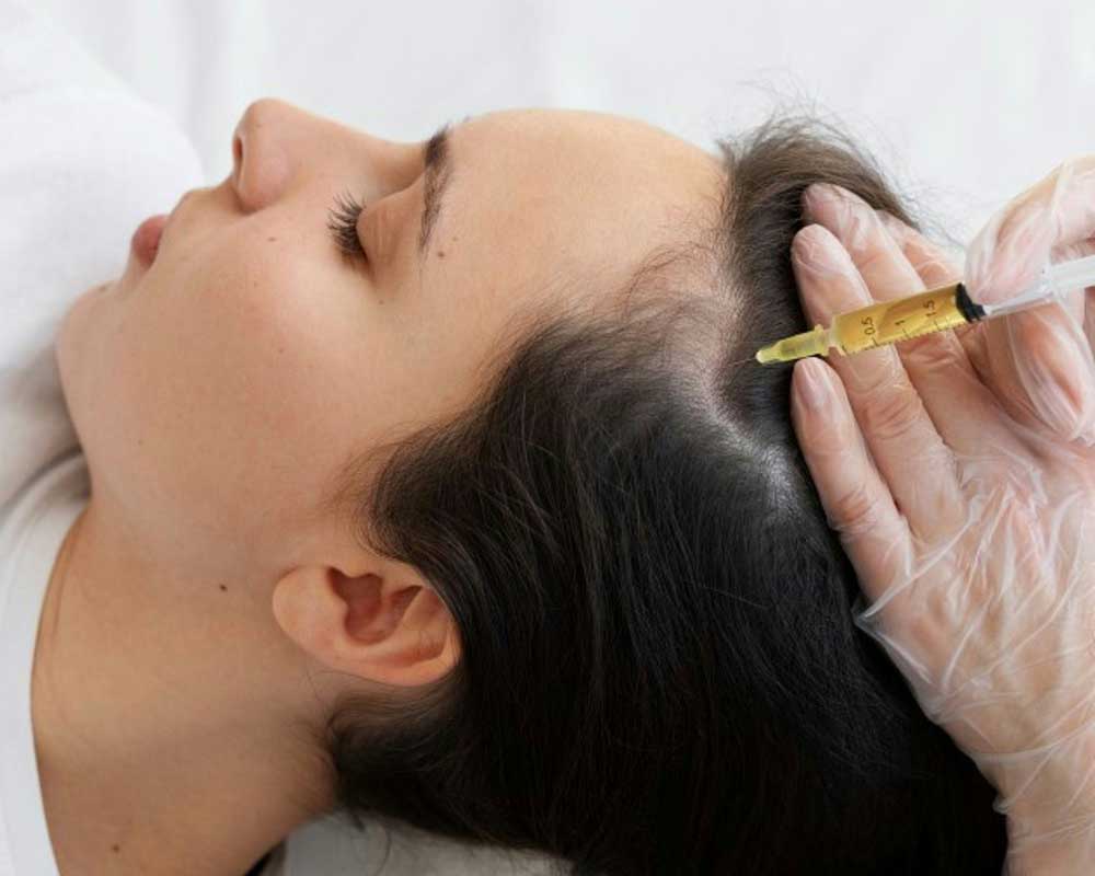 A photo of a patient having an injection to her scalp. This image is being used to represent Regenerative Injections